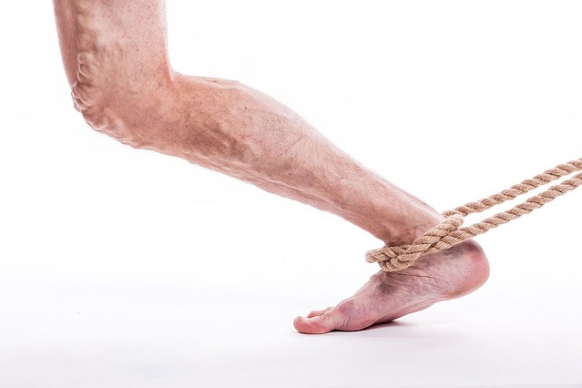 العرج المتقطع ما هي أسبابه و العوامل الخطيرة المؤدية له و أساليب علاجه