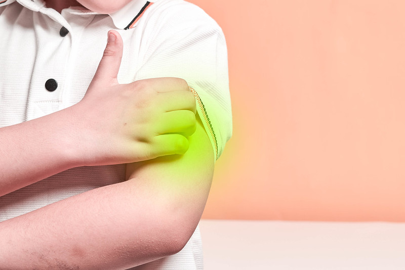 أعراض قمل الجسم و قمل العانة و أفضل الخيارات العلاجية والوقائية من العدوى